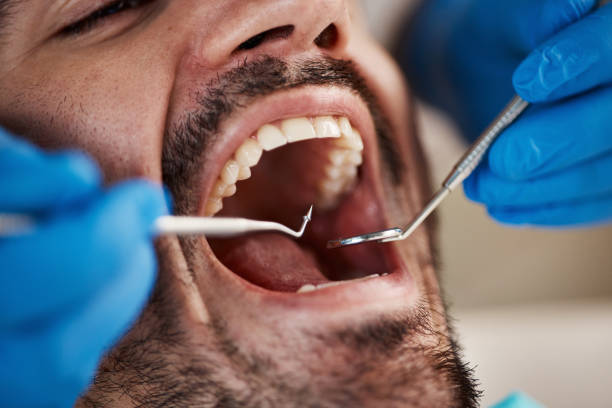 Best Emergency Dental Care for Sports Injuries in Stuttgt, AR